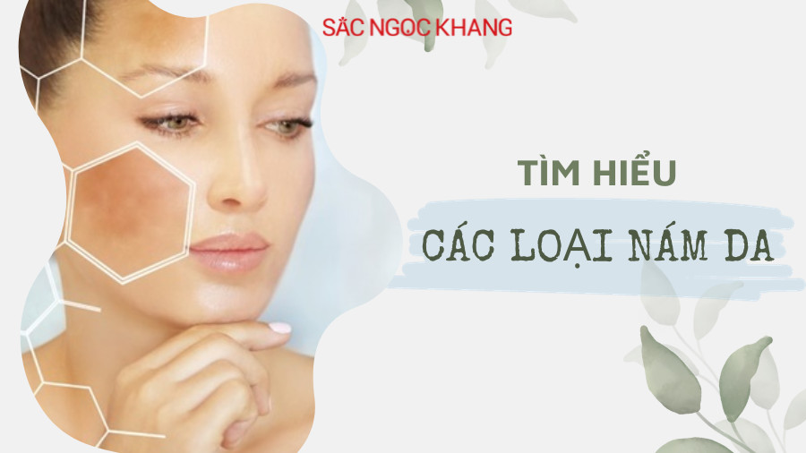 Tổng quan về các loại nám và cách khắc phục hiệu quả 2023