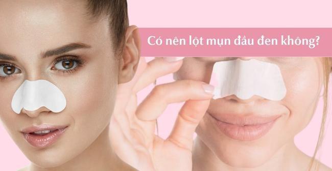 Có Nên Lột Mụn Đầu Đen Không? Lợi Ích Và Tác Hại Của Việc Lột Mụn